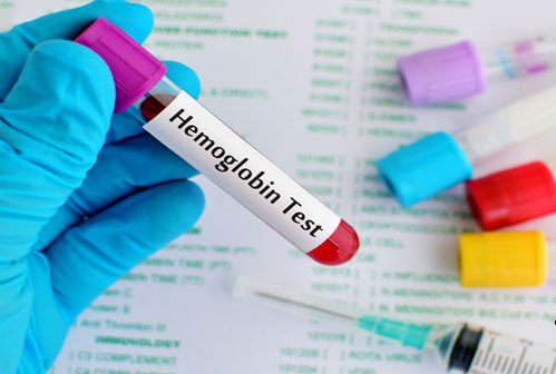 4 Tips Menjaga Kadar Hemoglobin Normal Saat Hamil