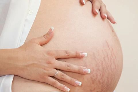 Kenali 6 Masalah Kulit pada Ibu Hamil dan Penyebab Terjadinya