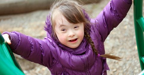 Memahami Penyebab Terjadinya Down Syndrome Sejak dalam Kandungan