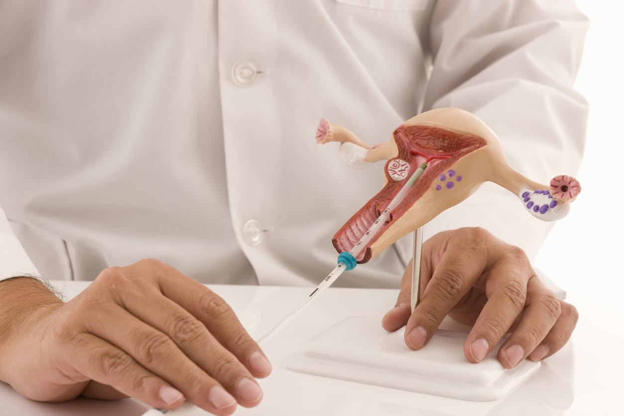 Sebelum Pasang KB IUD, Ketahui Dulu 4 Efek Sampingnya